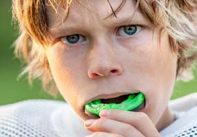 Protector bucal dental sobre medida personalizada jugador
