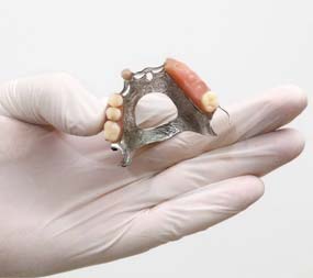 Reparación prótesis dental de arriba