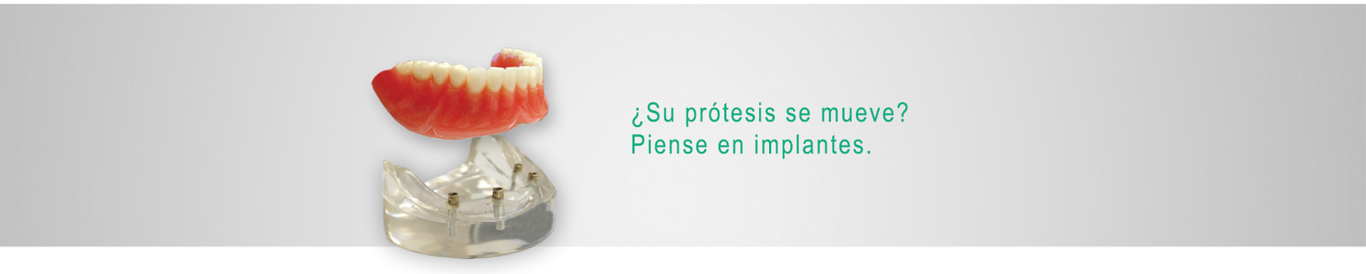 ¿Su prótesis se mueve? Piense en implantes.